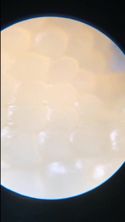 把鸡爪拿到显微镜下观察,放大后竟是这样,看完你们还敢吃吗?