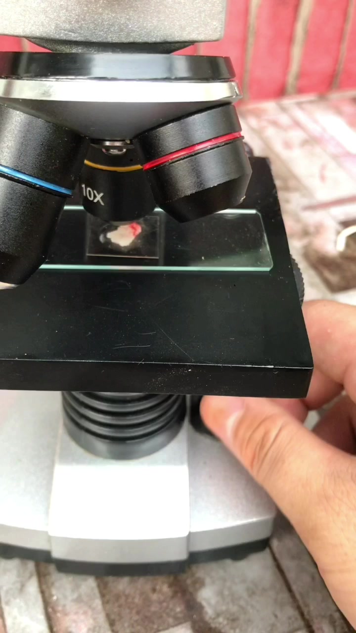 小龙虾在显微镜下,被放大100倍,有了新的发现