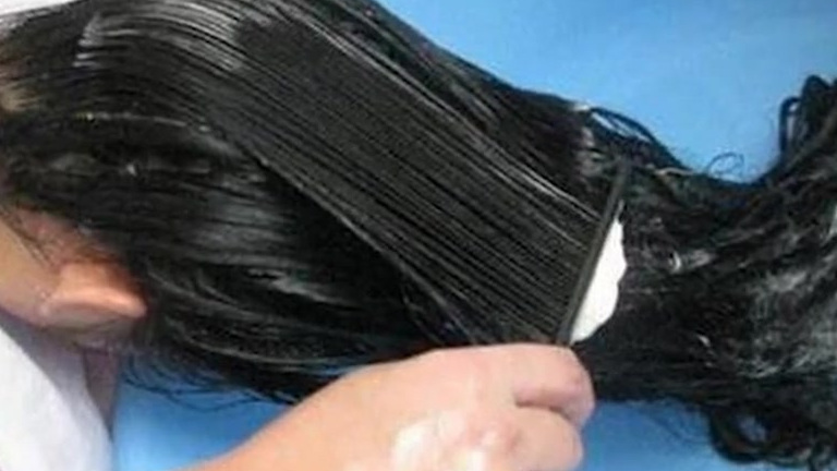 【大妈模仿小视频用敌敌畏洗头】51岁的李大妈在网上看到一段小视频,说用敌敌畏洗头,可以杀灭