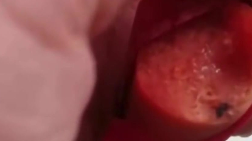 【又一起?女子称双汇火腿肠吃到一半发现虫:已投诉,但无人解决】9月18日,继双汇火腿肠被曝