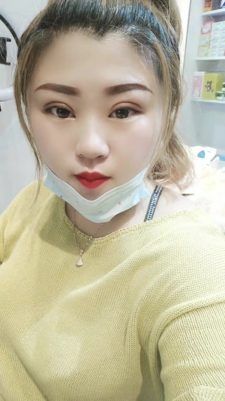 这就是整容付出的代价,典型的包子脸,实在看不下去