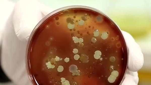 【摒弃强制饲喂 法国科学家利用细菌养出天然鹅肝】近日,法国科学家现在正在开发“天然鹅肝”,