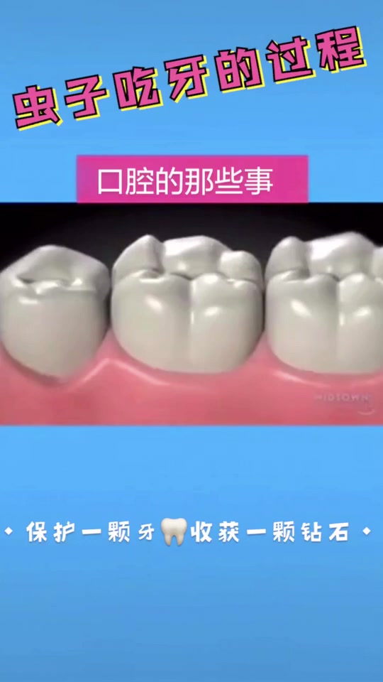 虫子吃牙的过程?!看完立马想去刷下牙!