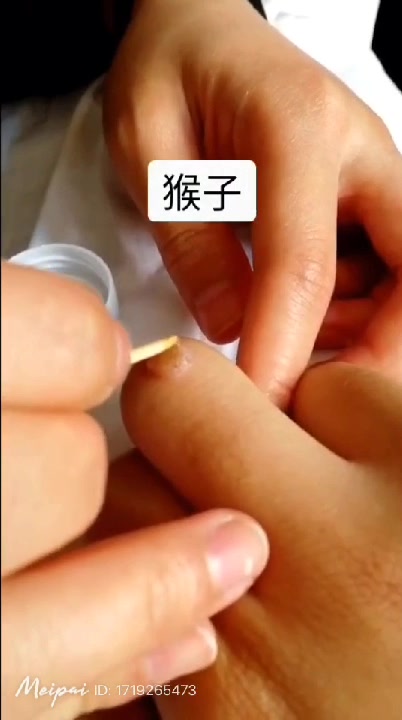瘊子来了,猴子刺猴