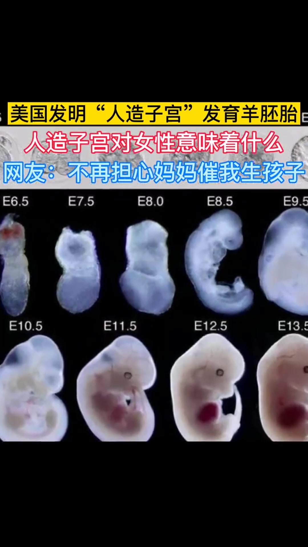 美国发明“人造子宫”发育羊胚胎,人造子宫对女性意味着什么?