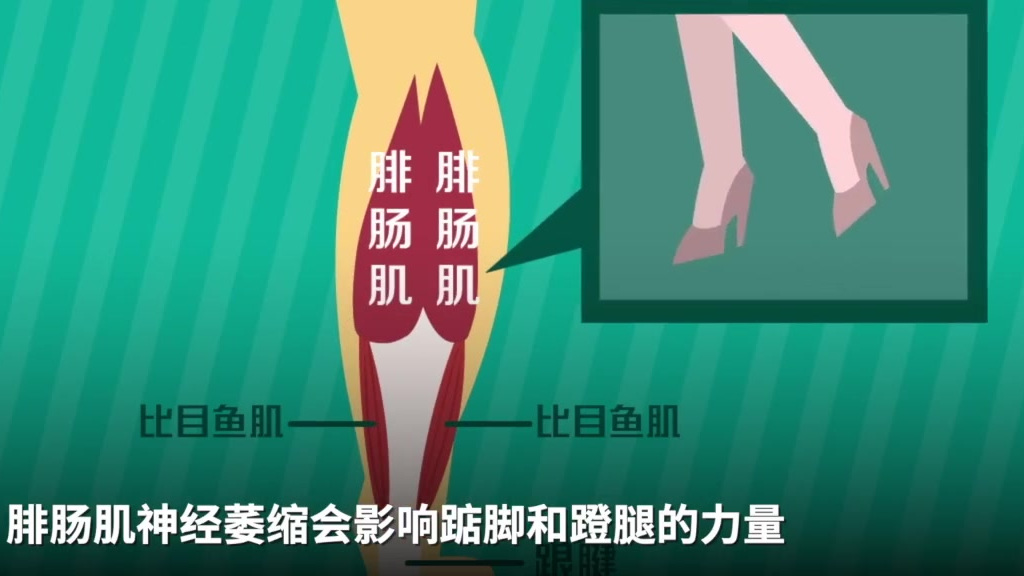 【切神经瘦腿?医生称小腿肌肉阻断术或可致残】5月下旬,有网友做了“小腿肌肉阻断术”并在社交