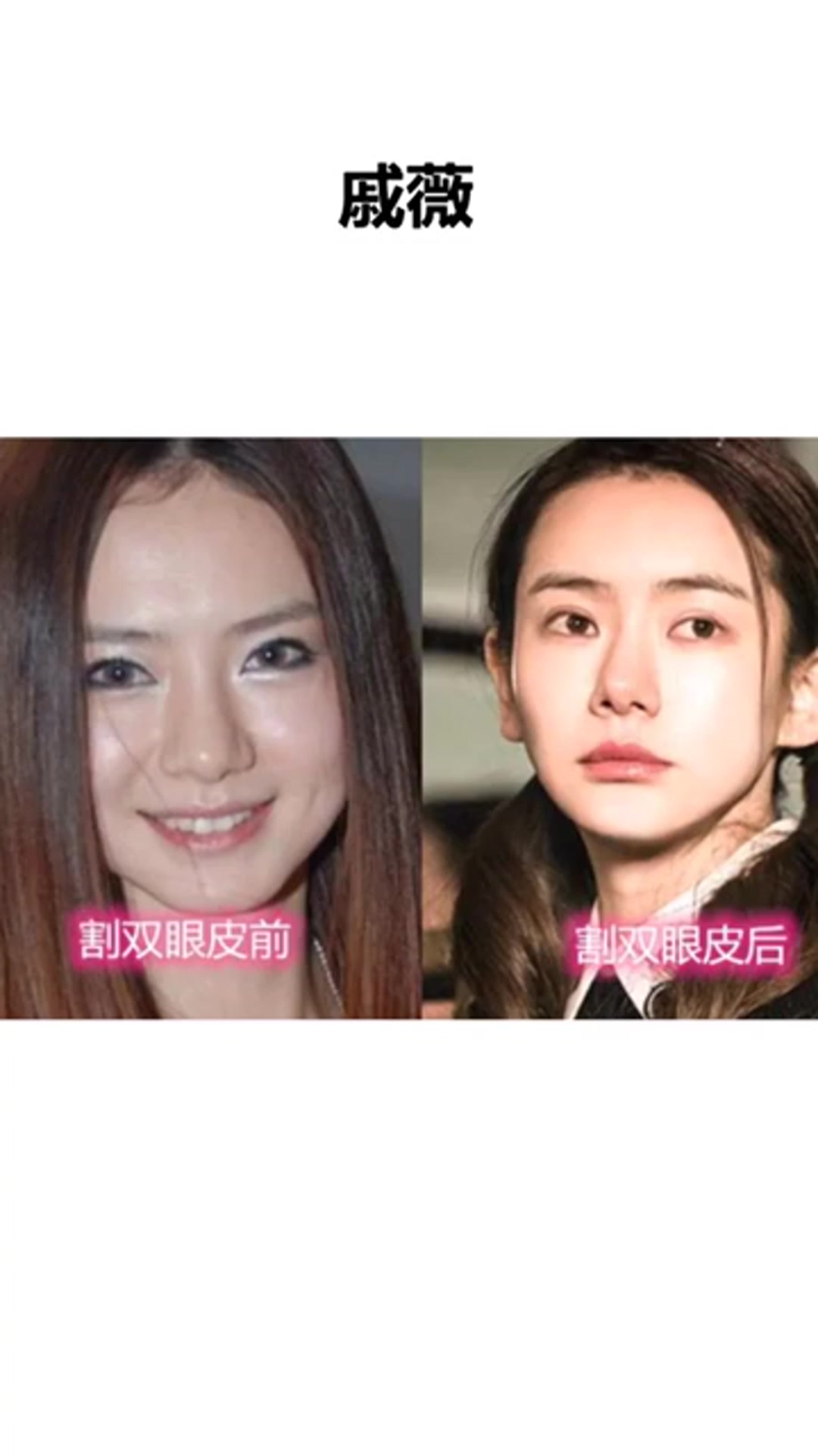 明星割双眼皮的前后对比,你还认得出吗,罗志祥是换了个人吧?