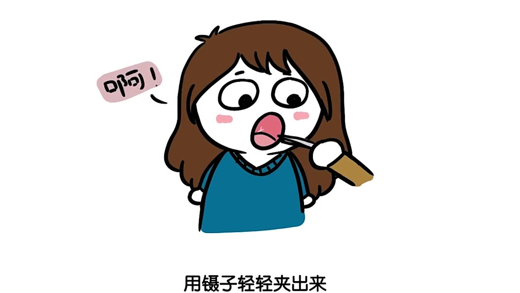 鱼刺卡到喉咙的那些错误急救方法。