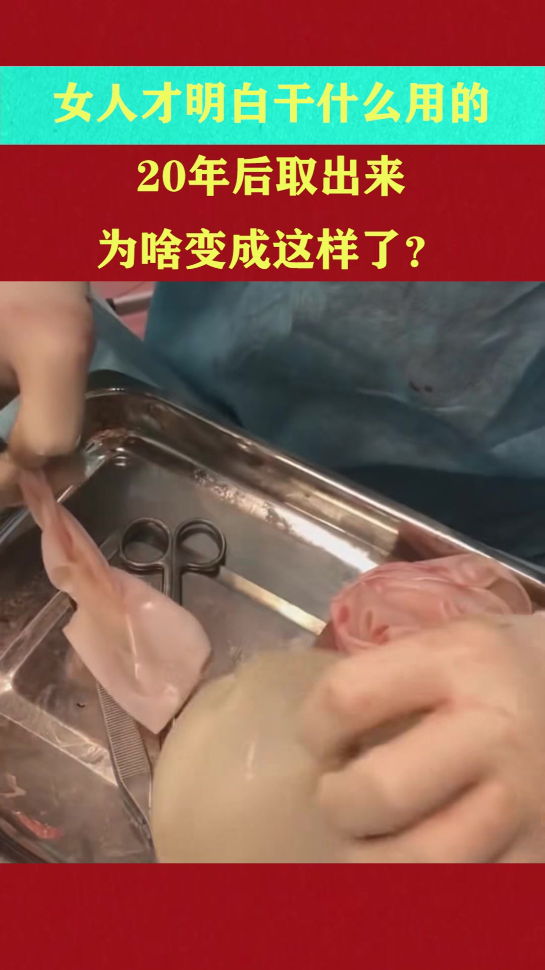 女人才知道这是干什么用的,二年后取出来,没想到竟变成了这样