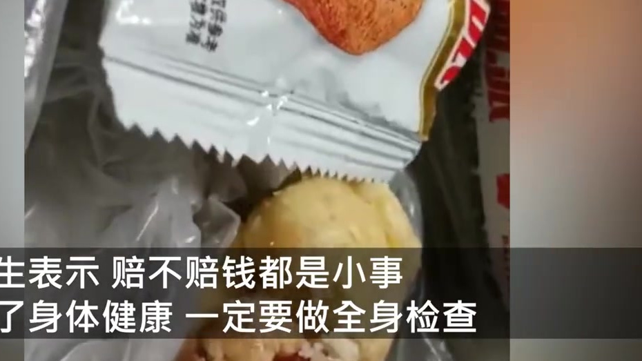 yue了[吐]【男子称吃达利园蛋黄派吃出带血牙齿 ,售后:已安排当地工作人员处理 】8月1