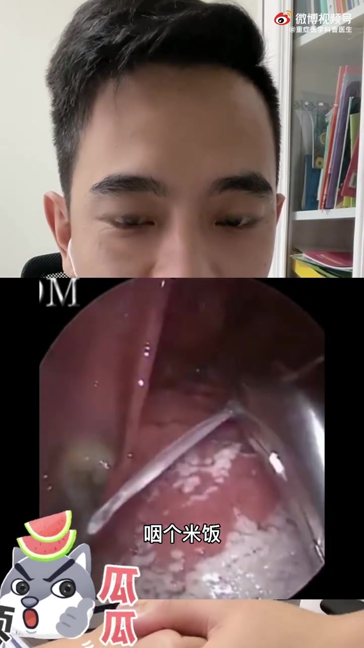卡在喉咙里的鱼刺是这么取出来的!#夏日健康总动员#