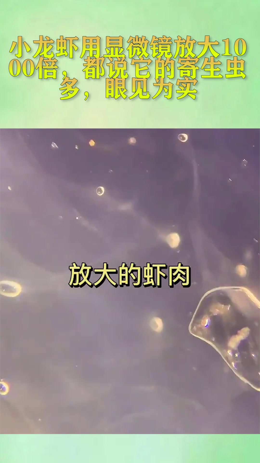 小龙虾用显微镜放大1000倍,都说它的寄生虫多,眼见为实