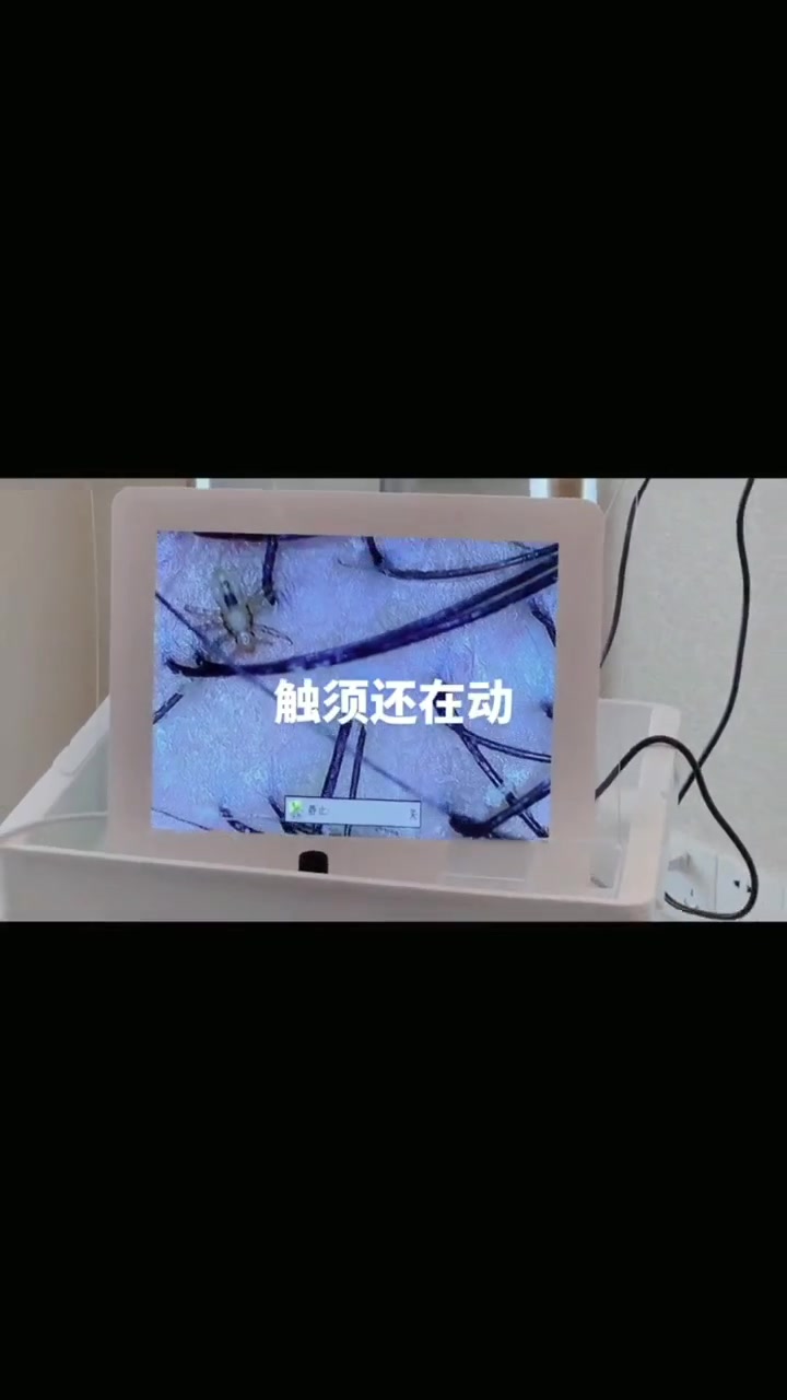 虱子是什么样子的