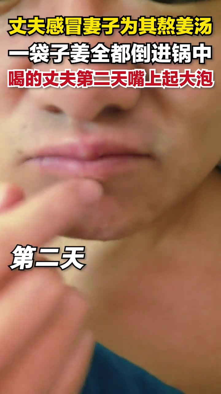 丈夫感冒妻子为其熬姜汤,一袋子姜全都倒进锅中,喝的丈夫第二天嘴上起大泡