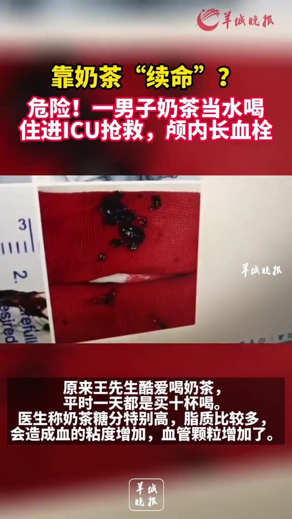 靠奶茶“续命”?危险!一男子奶茶当水喝住进ICU抢救,颅内长血栓