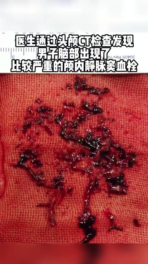 都是奶茶惹的祸!深圳一男子奶茶当水喝住进ICU