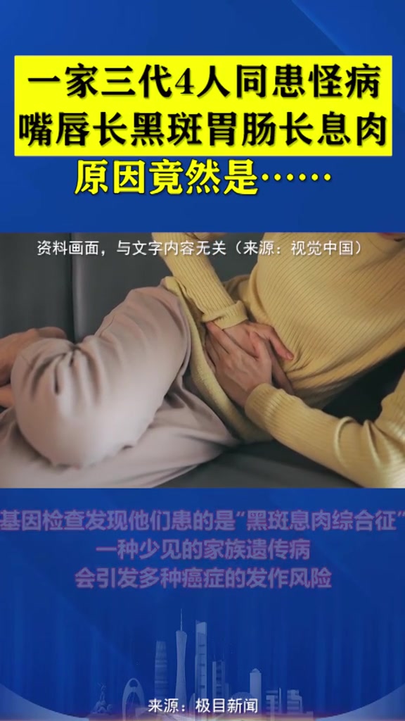 一家三代4人同患怪病,嘴唇长黑斑胃肠长息肉。原因竟然是……