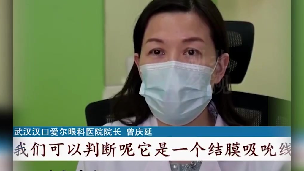 【#2岁女童眼睛里掏出6条活虫#,医生:宠物身上常见寄生虫】近日,湖北武汉。据湖北广电,一