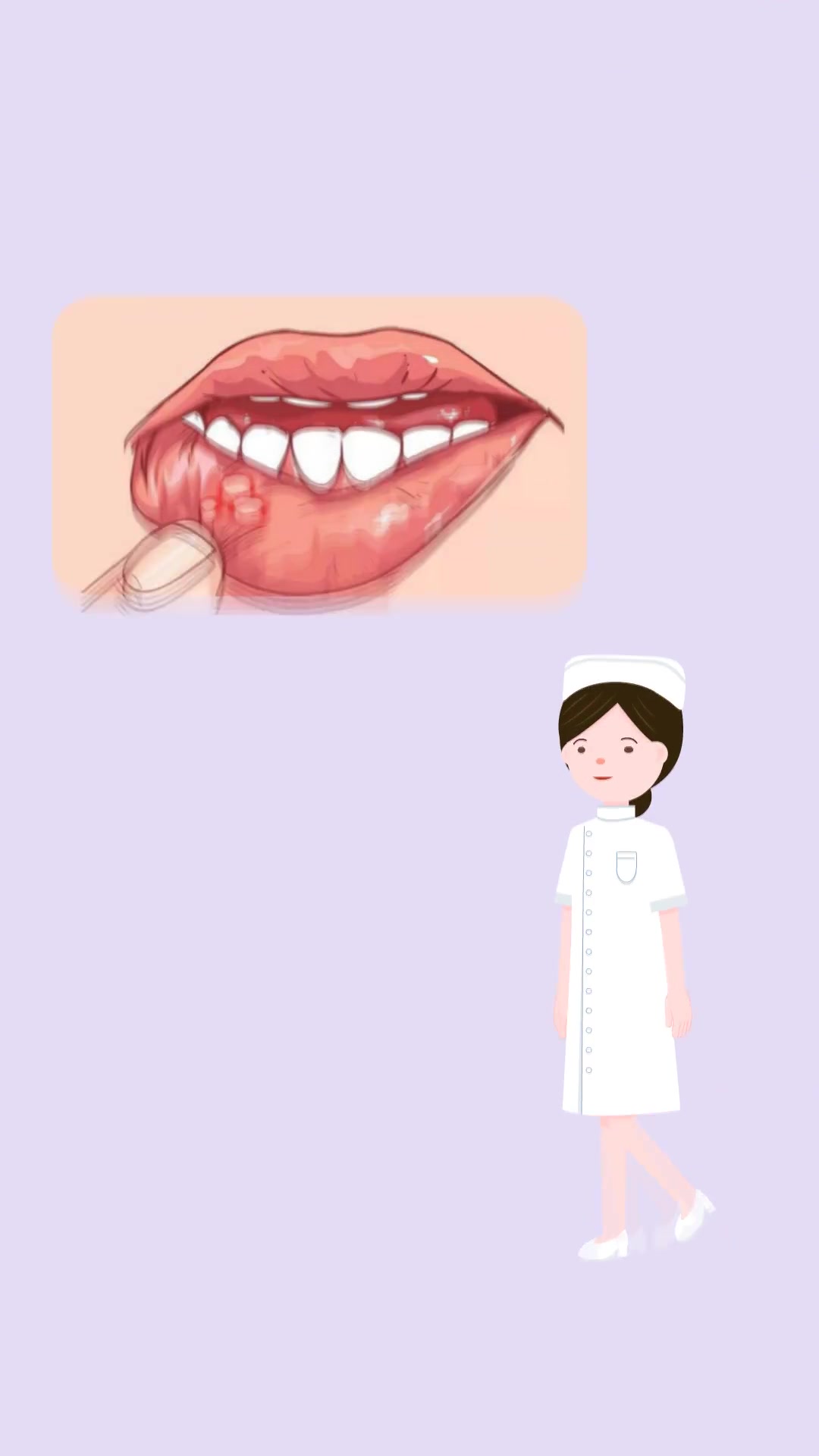 口腔尖锐湿疣症状图片