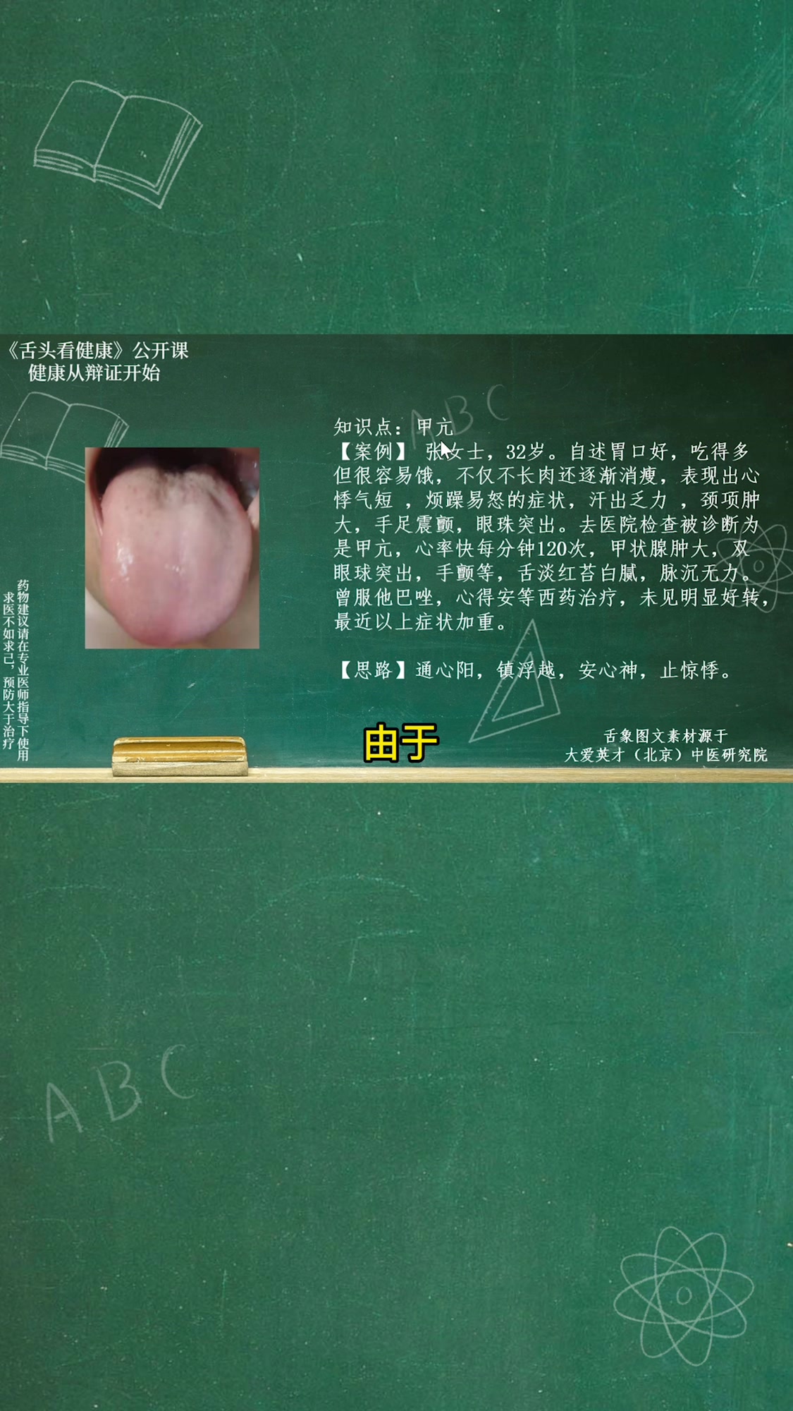 舌象分析:容易出汗,脖子肿大,甲亢,舌苔白腻等提示体内阳弱