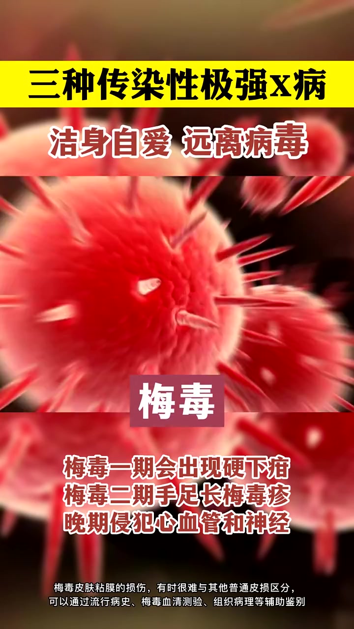 这种三种病传染能力极强,答应我要爱护自己!