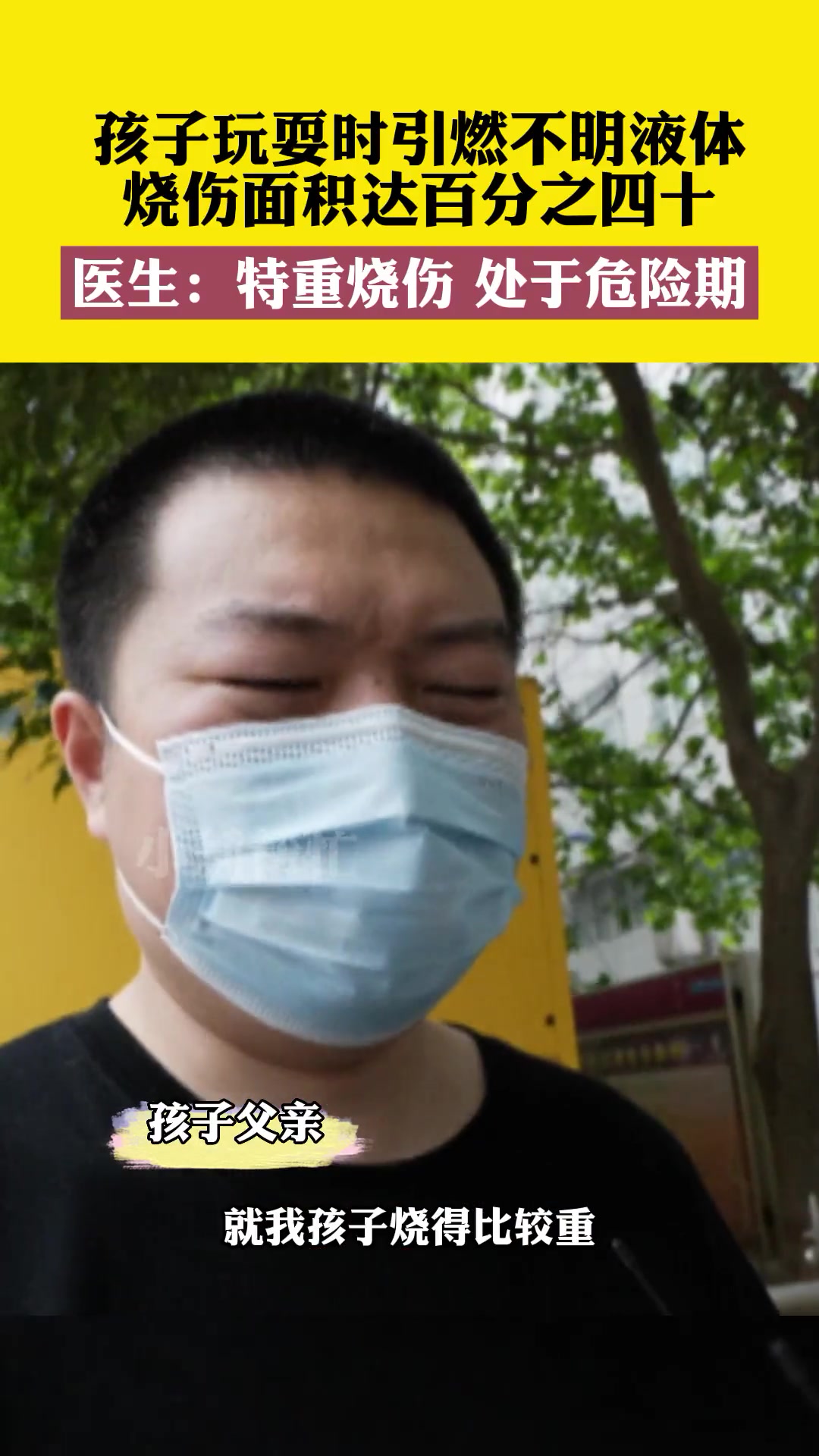 5月20日河南郑州,孩子玩耍时引燃不明液体,烧伤面积达百分之四十,医生:特重烧伤,处于危险