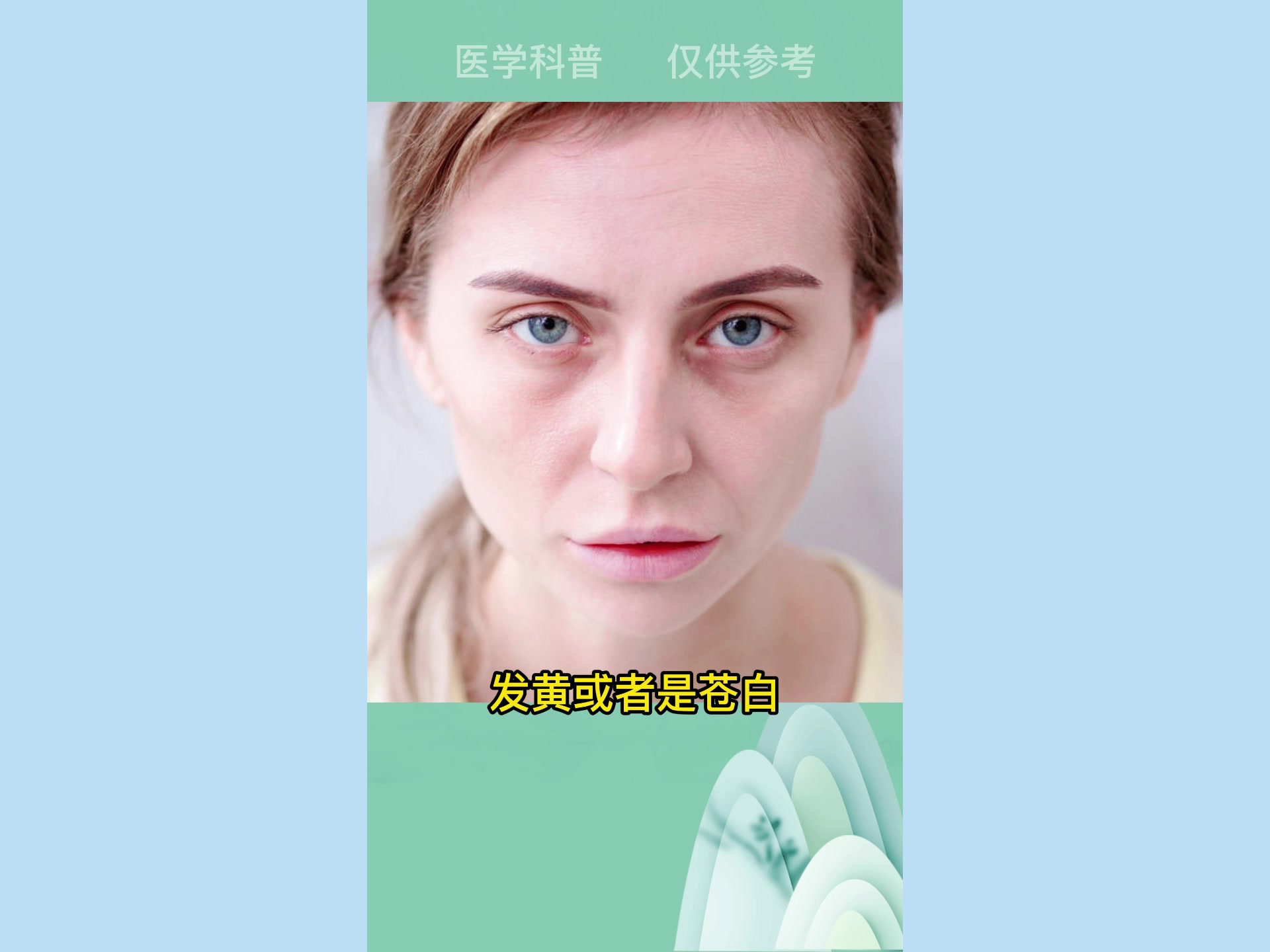 脸色发黄怎么办?女性养颜千年古方—八珍汤