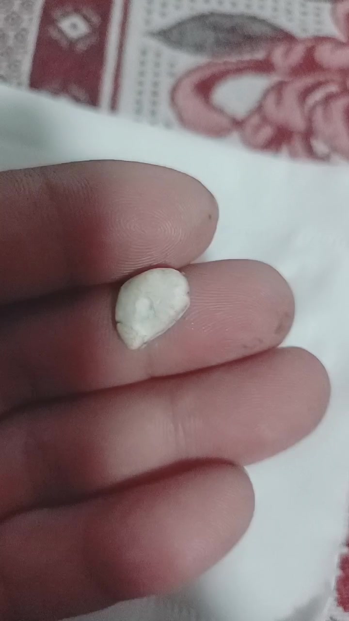 我吃鱼从带鱼身上吃出的,请问是鱼宝吗