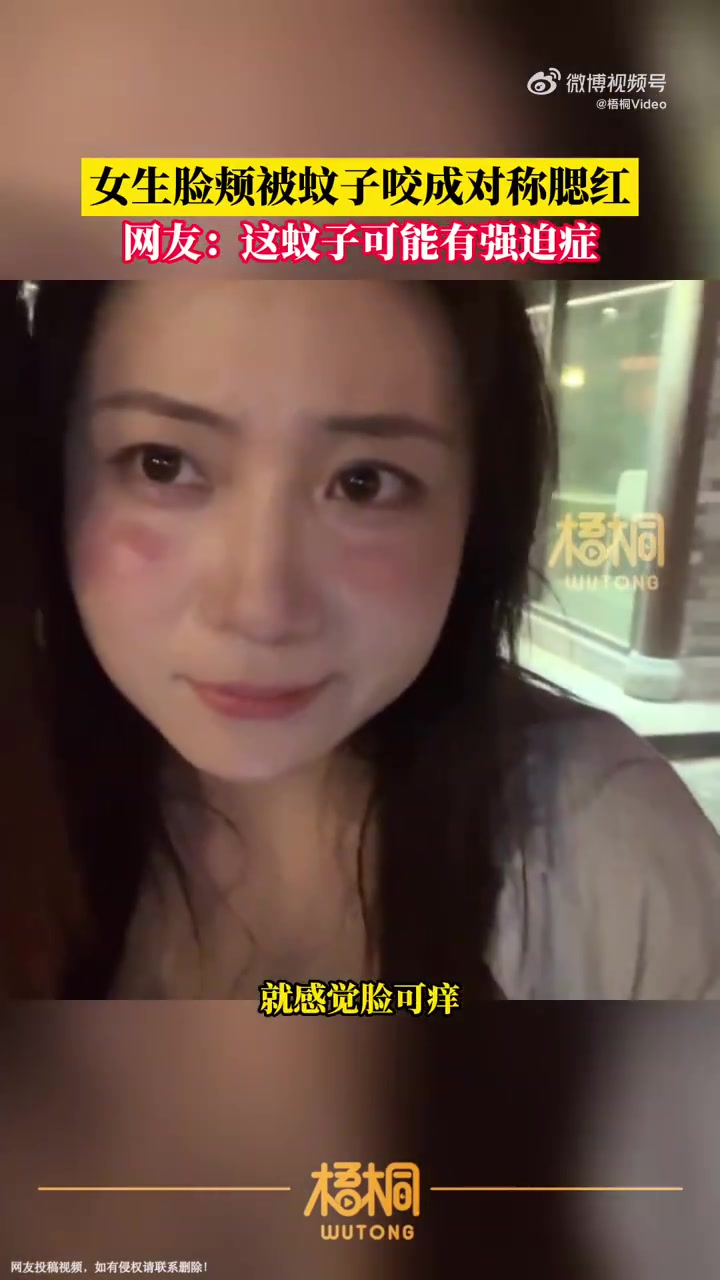 「强迫症!蚊子在女生脸颊咬出对称腮红「笑哭」」7月18日,河南开封。一女生在开封游玩拍照时