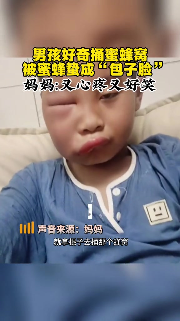 男孩好奇捅蜜蜂窝,被蜜蜂蛰成“包子脸”,妈妈:又心疼又好笑