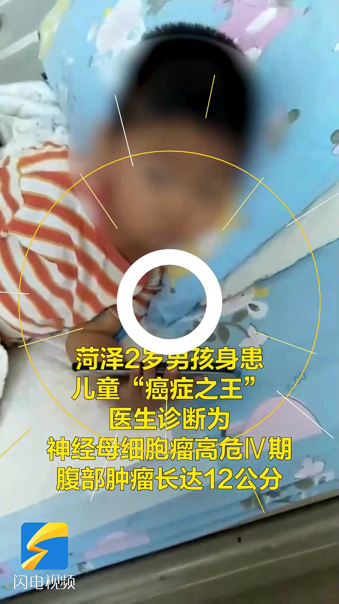 菏泽2岁儿童腹部长肿瘤 希望好心人能帮帮他