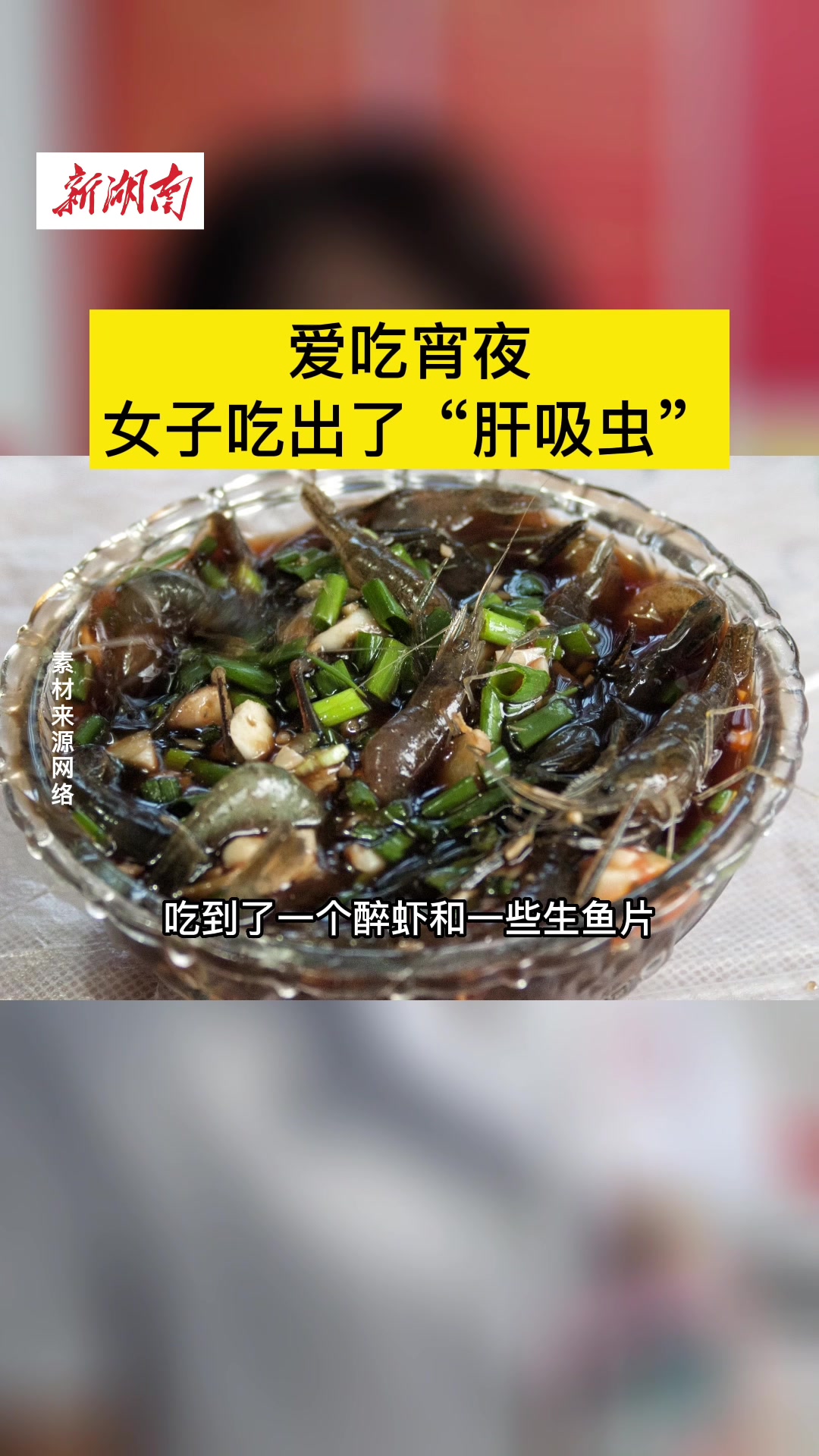 爱吃宵夜,女子吃出了“肝吸虫”