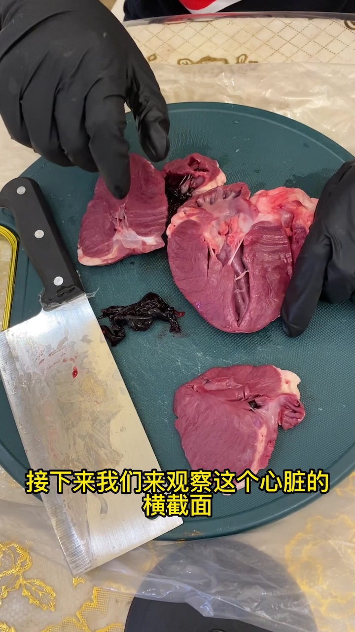 生物作业之解剖猪心实验