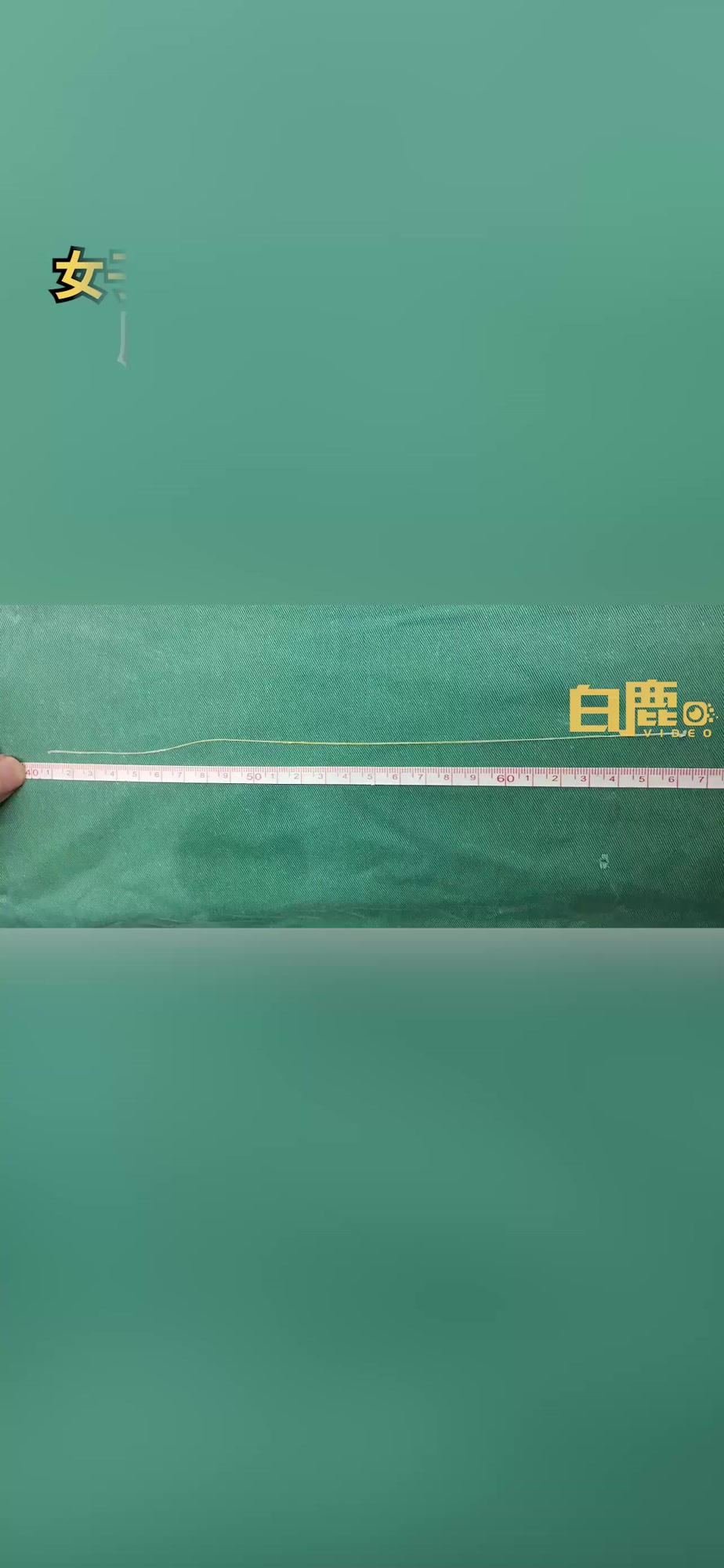 女子脑内取出27厘米活虫,这些食物千万别生吃