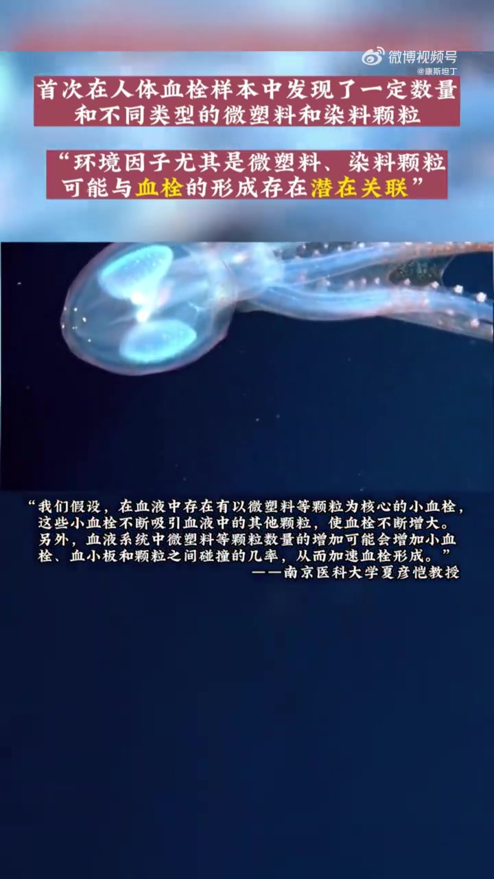 21岁男子长期熬夜吸出10块血栓 人类血栓中首次发现微塑料 现在很多人的生活就是这样,工作