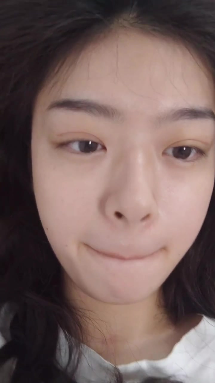 全切双眼皮是两个月啦,肉条比以前好了很多,很自然了