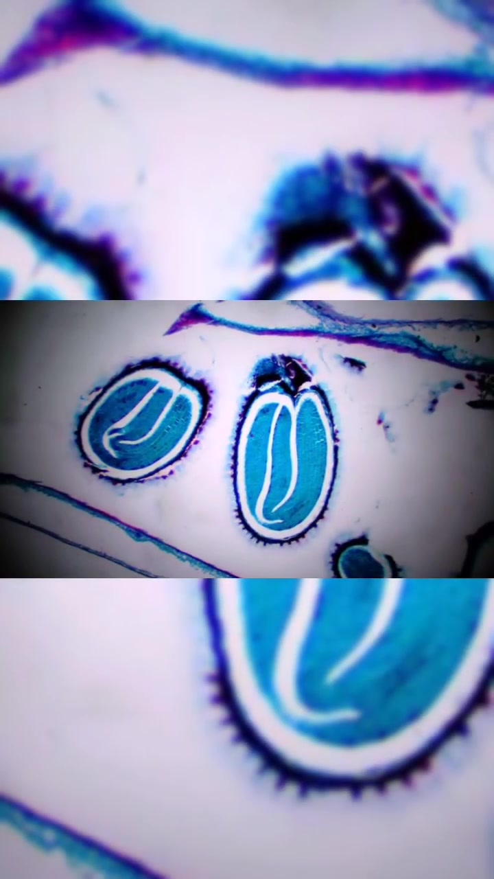 第69集|荠菜老胚切片 不明生物 装片 生物装片