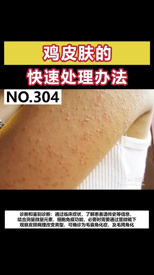 3-鸡皮肤的快速处理办法-dy
