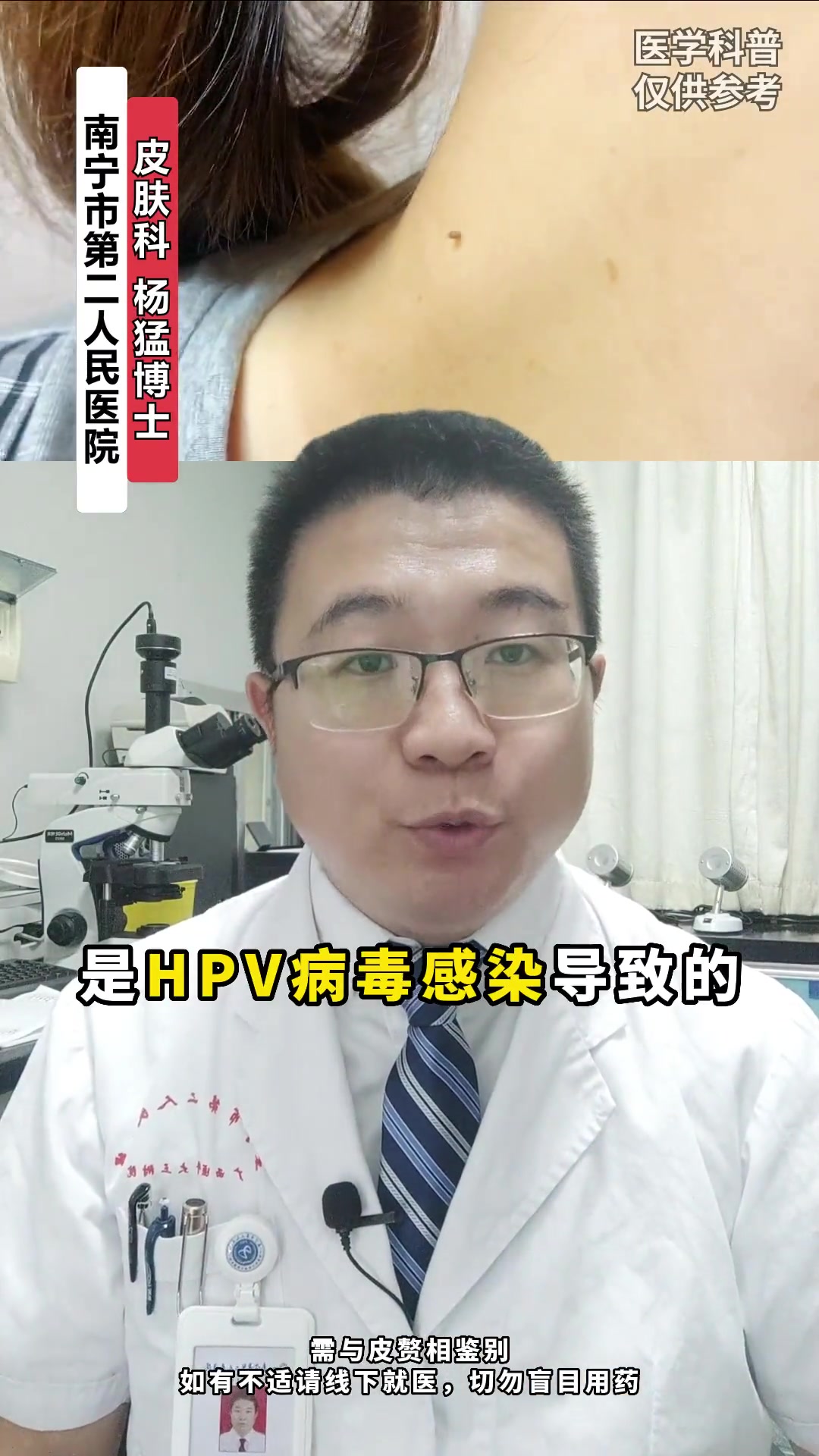 脖子上 长小肉条?丝状疣 HPV 医学科普