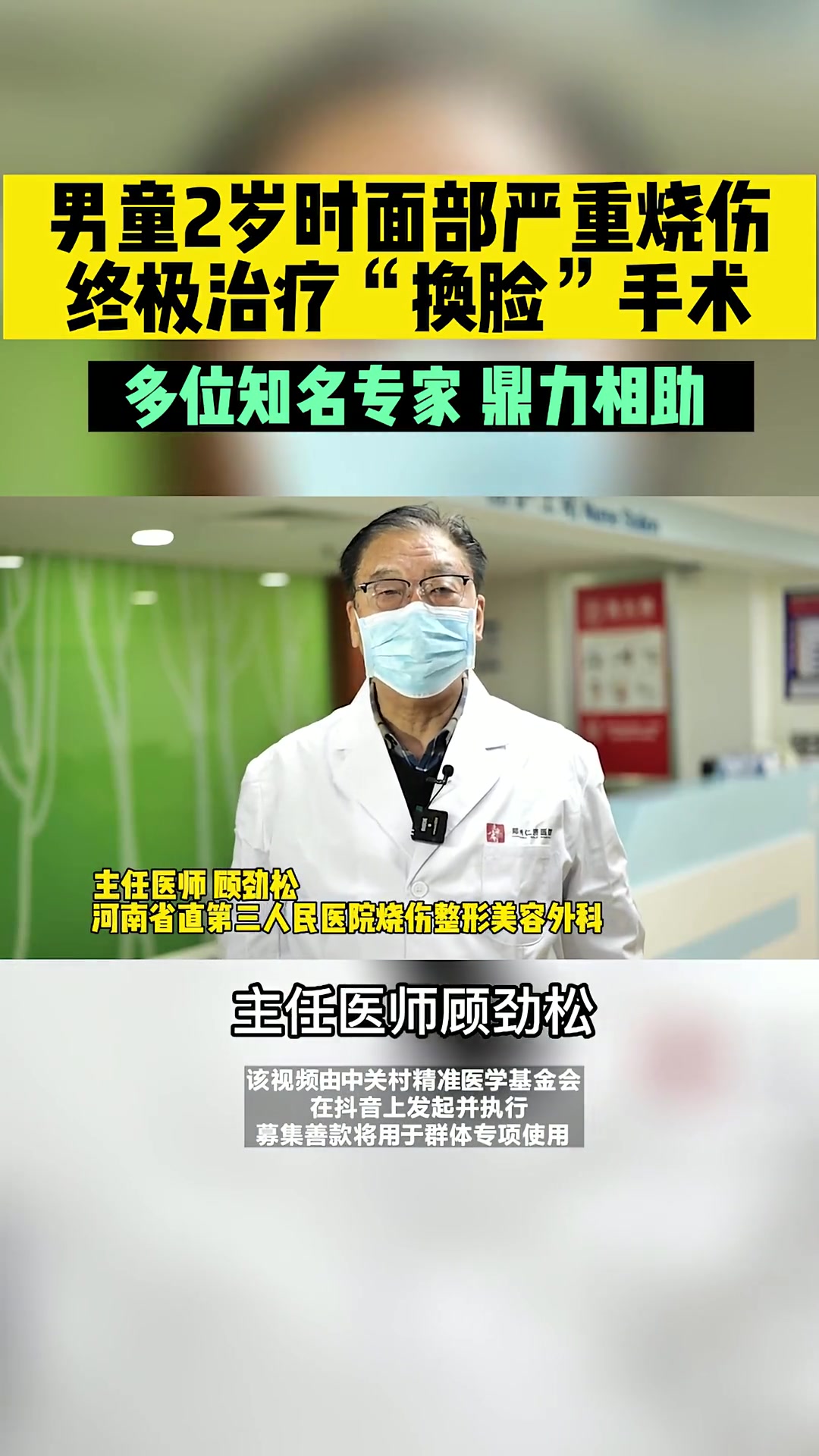 男童两岁时面部严重烧伤,终极治疗将进行换脸手术,让我们一起为他加油!