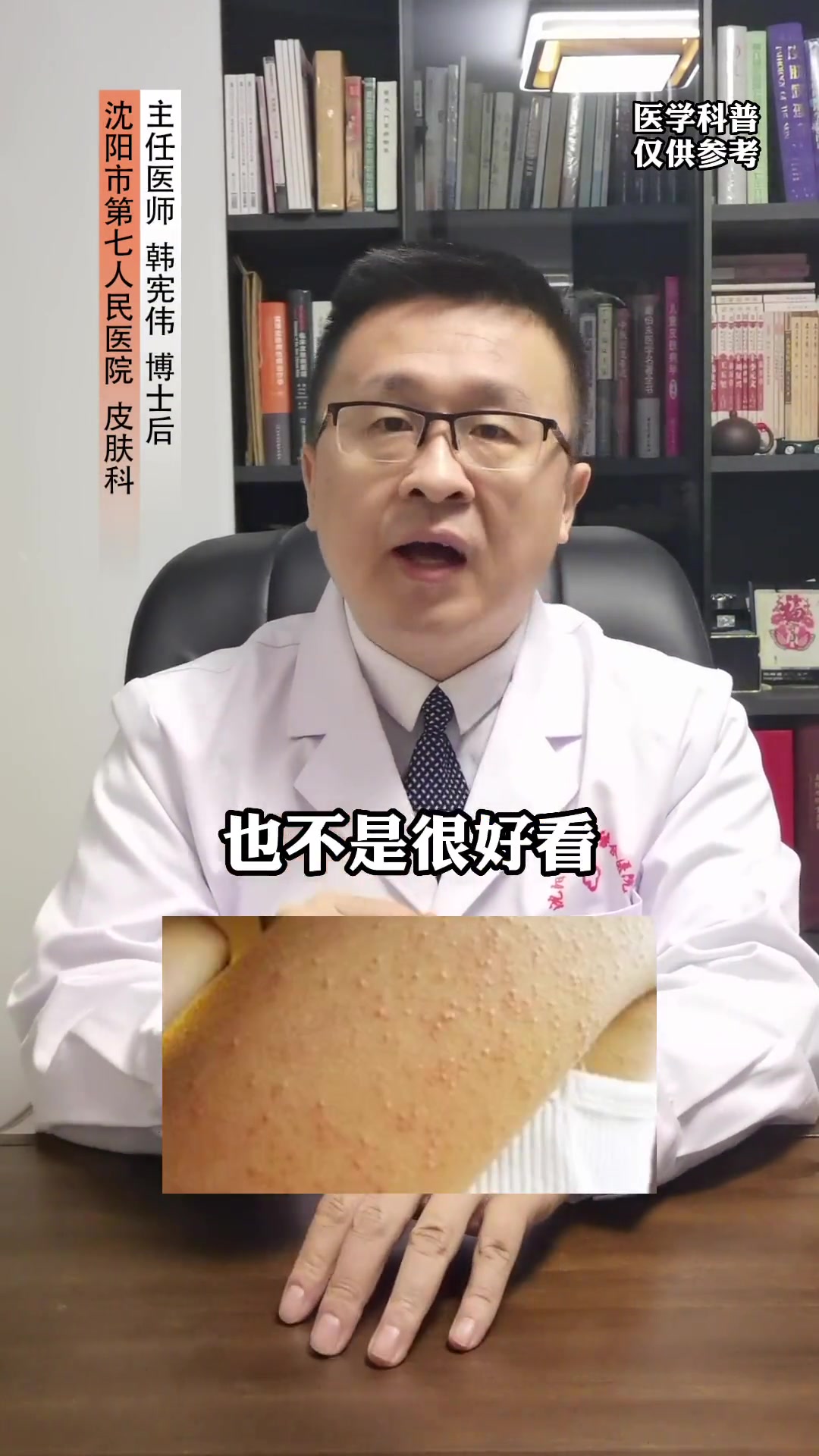 身上长了密密麻麻的小疙瘩,试试这个小方法 医学科普 毛周角化 皮肤