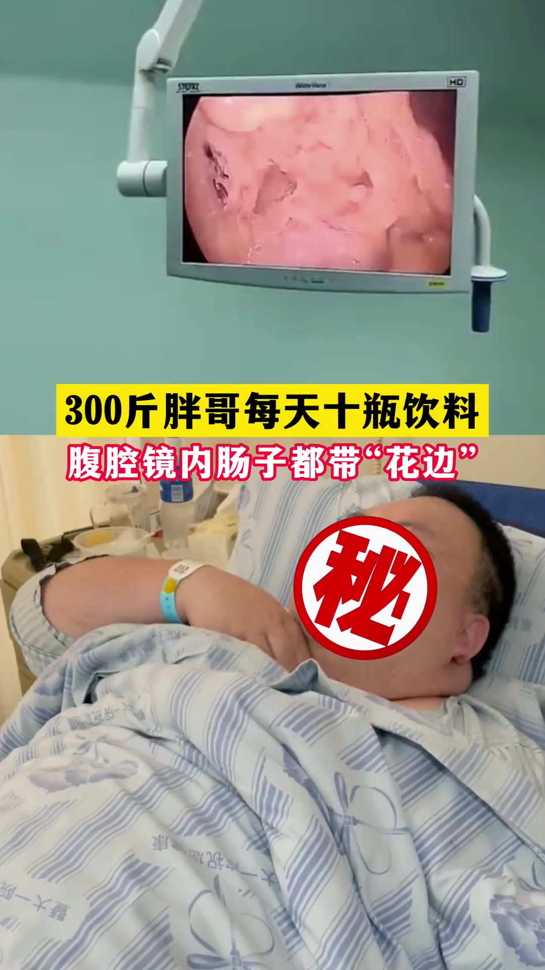 第1集|炸鸡、汉堡、可乐、披萨这些是不是都是你的最爱?那你可得小心了!广东减重手术 肥胖 