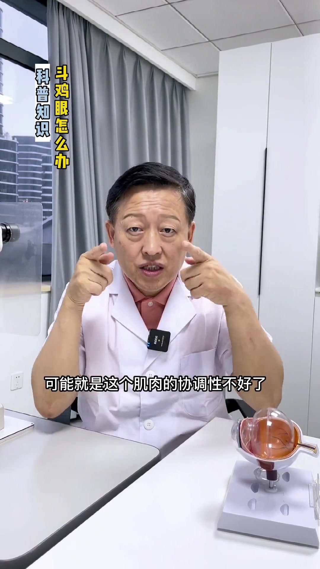 斗鸡眼就是斜视,身边有这样的朋友可以到门诊让医生矫正 科普 手术 斗鸡眼