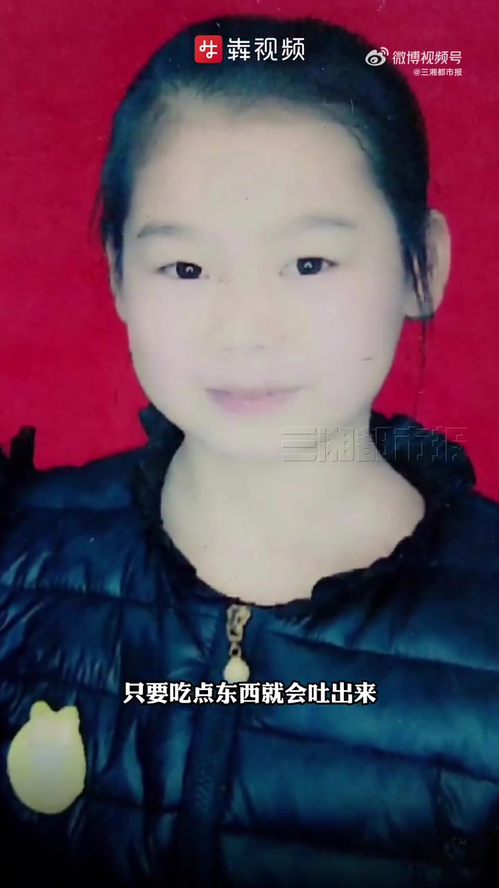 「罕见病女孩1年减肥25斤直播唱歌找回自信」韦格纳肉芽肿,一种连名字都很少听说的罕见病,让