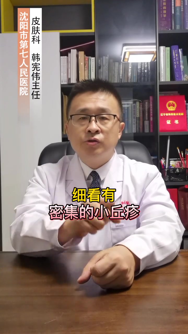 脸颊红红黑黑的,有一些小疙瘩,摸起来不舒服,其实这不是鸡皮肤,我们可以这样处理 科普 鸡皮