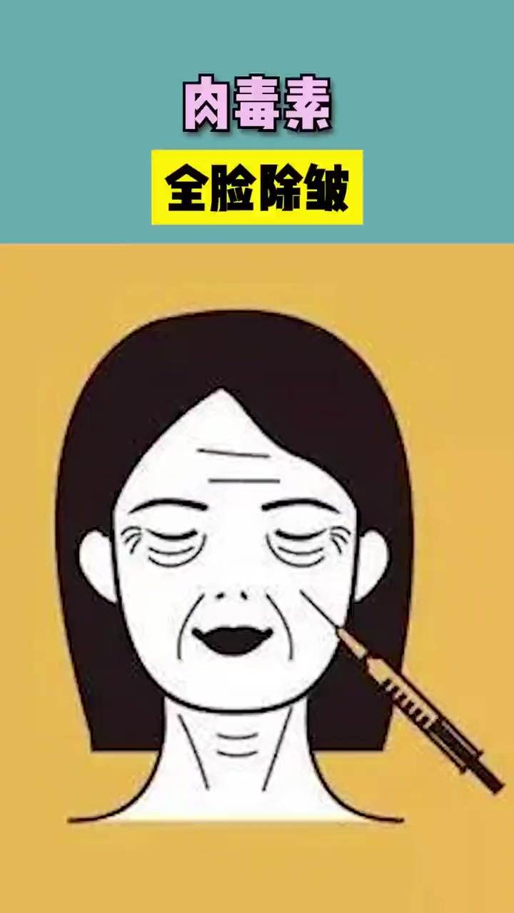 肉毒素全脸除皱的适用部位!肉毒 面部皱纹 医学科普