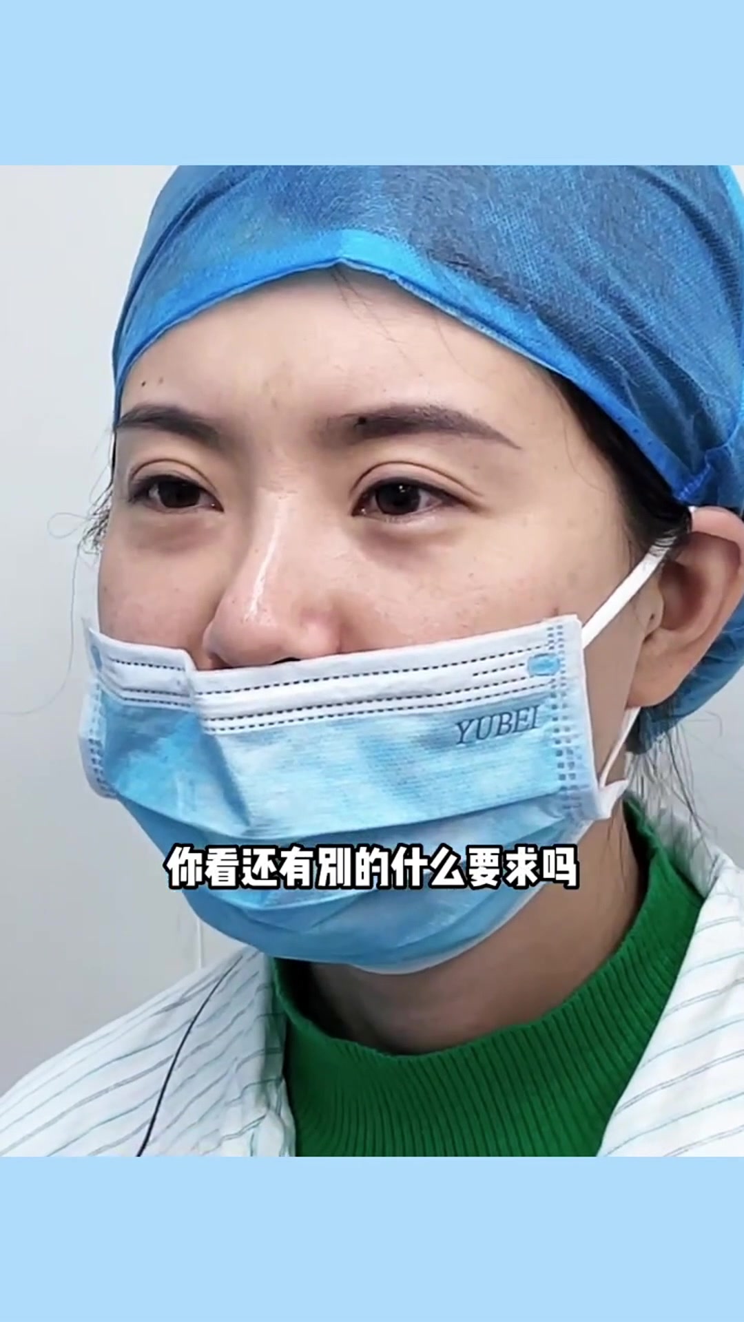 不自然肉条感严重做修复,只为追求自然双眼皮,术后完美达到预期