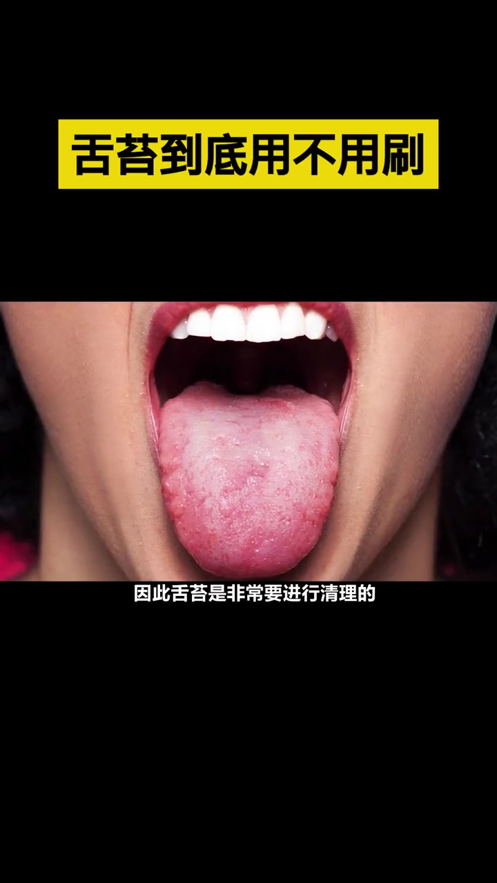 为什么说你的舌头,比垃圾场还要脏!好物 舌苔