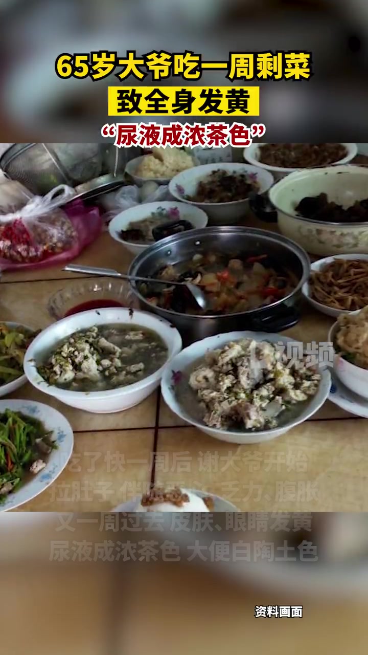 「65岁大爷连吃一周剩菜全身发黄:饭菜在冰箱里放太久被生食污染」3月17日,广东深圳,深圳