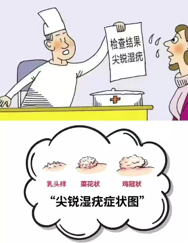 尖锐湿疣症状图 上海都市医院